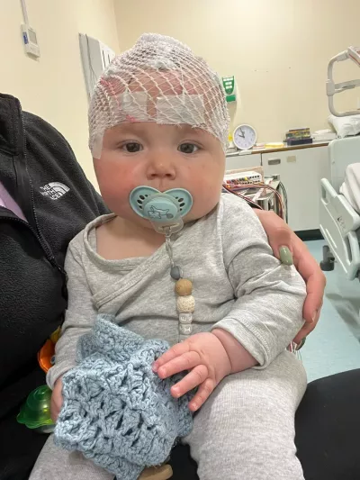 A baby with a pacifier looks to camera while their head is connected to an EEG.